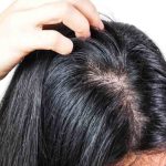 Penyebab Rambut Berminyak serta Cara Mengatasinya